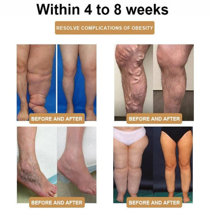 RicheranTM Ultrasonic Fat Blasting and Detoxing Wristband⏱️(for all lymphatic problems and obesity)