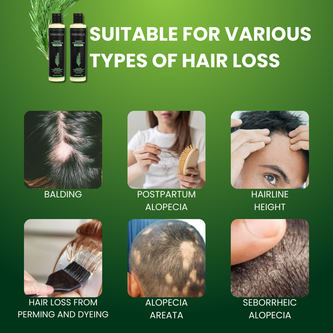 💚𝐓𝐢𝐰𝐨𝐫𝐥𝐝™Hair Growth 🧴Shampoo: Restore Thicker, Healthier Hair Naturally