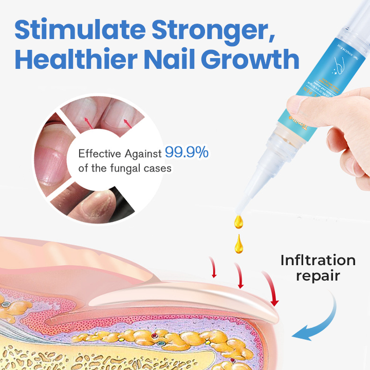 Timilk® MycoErase Nail Revive Pen