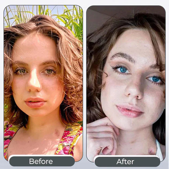 🎅Tiworld™ 𝑺𝒑𝒆𝒄𝒕𝒓𝒂𝑬𝒚𝒆 𝑪𝒐𝒍𝒐𝒓 𝑪𝒉𝒂𝒏𝒈𝒊𝒏𝒈 𝑫𝒓𝒐𝒑𝒔 𝑷𝒓𝒐 – Made in the USA & FDA-Certified🎄