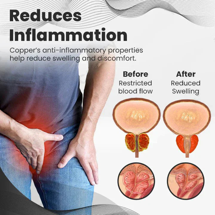 【 ✨Official Brand Store ✨】HOOMWELL™ CopperMag Prostate Therapy Ring