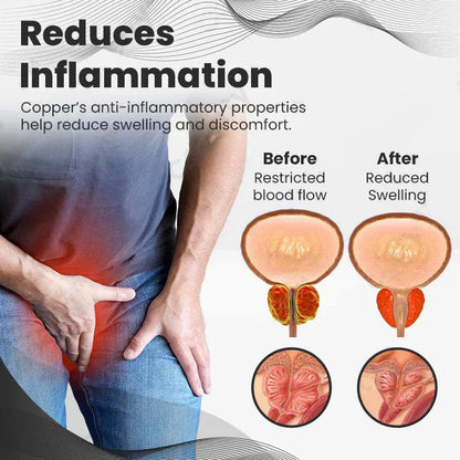 【 ✨Official Brand Store ✨】HOOMWELL™ CopperMag Prostate Therapy Ring