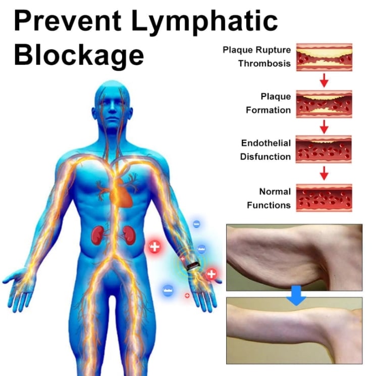 RicheranTM Ultrasonic Fat Blasting and Detoxing Wristband⏱️(for all lymphatic problems and obesity)