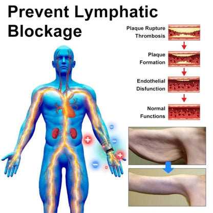 RicheranTM Ultrasonic Fat Blasting and Detoxing Wristband⏱️(for all lymphatic problems and obesity)