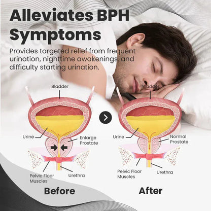 【 ✨Official Brand Store ✨】HOOMWELL™ CopperMag Prostate Therapy Ring